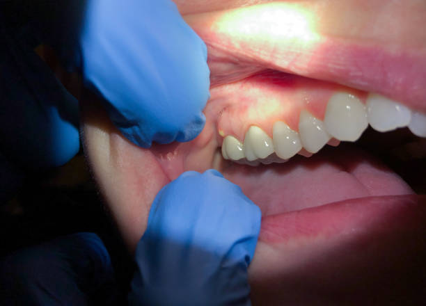 Best Weekend Emergency Dentist in Seaside, CA