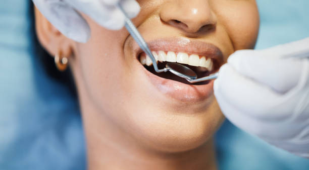 Best Orthodontic Emergency Dentist in Seaside, CA