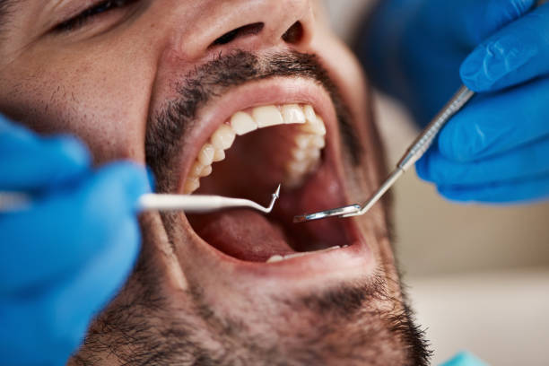 Best Emergency Dentist for Knocked-Out Tooth in Seaside, CA